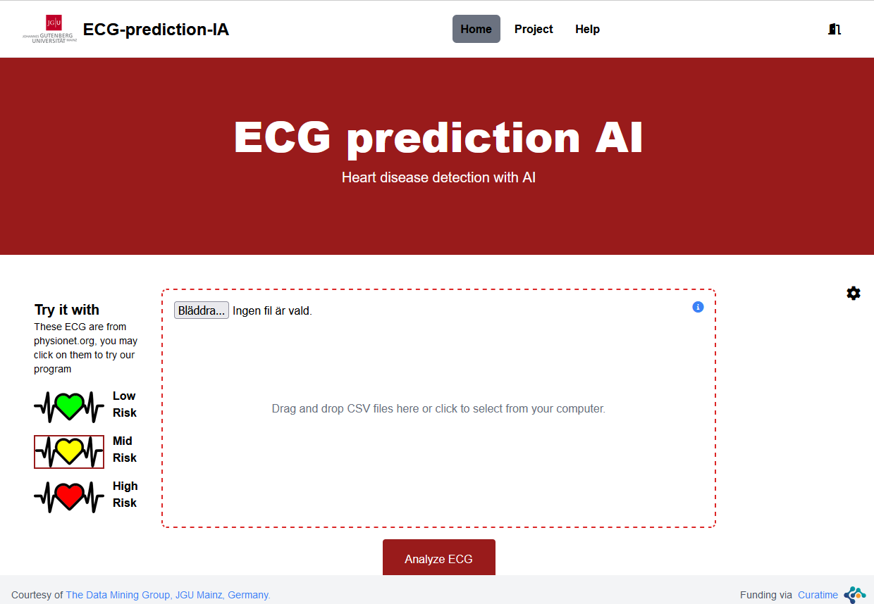 ECG Prediction AI